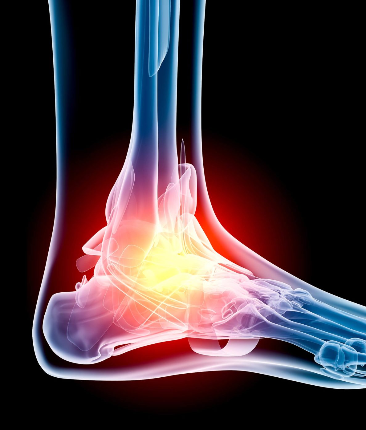 Ankle Pain