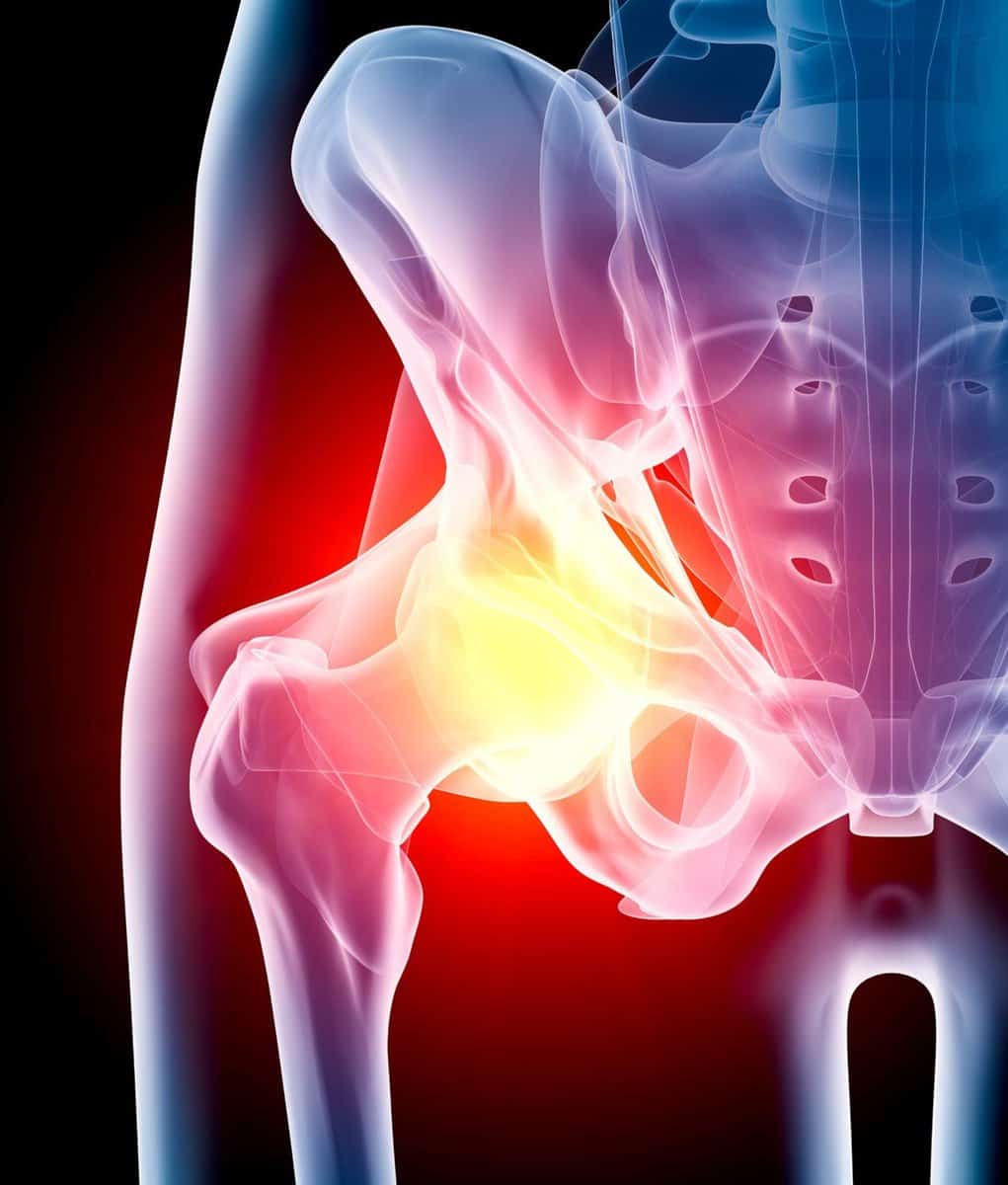 Hip Pain