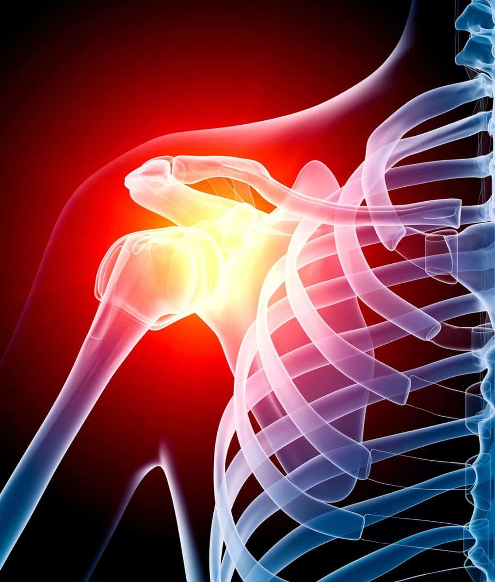 Shoulder Pain